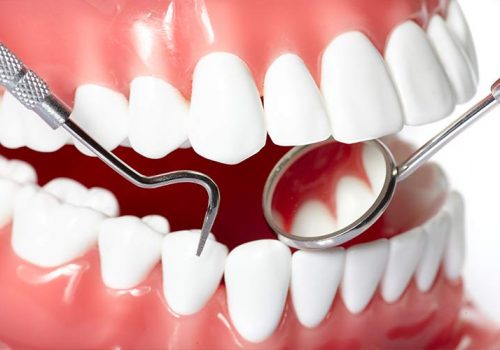 control de vos dentition et traitement des carie